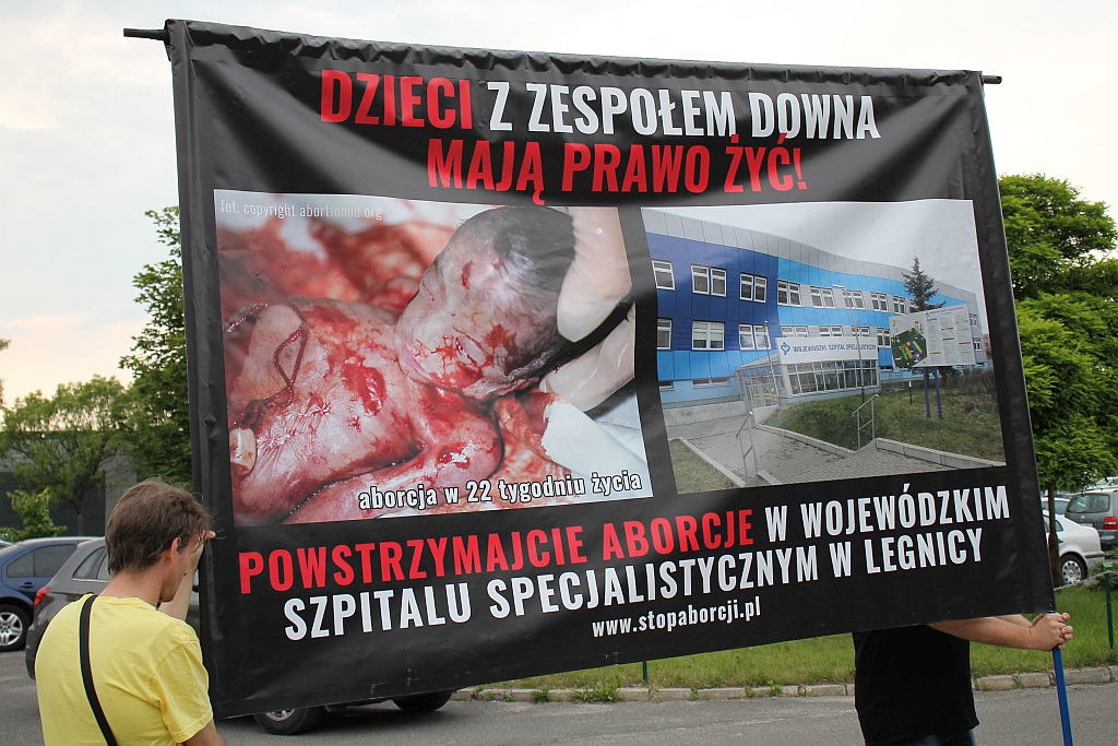 Obrońcy życia poczętego protestowali przed szpitalem