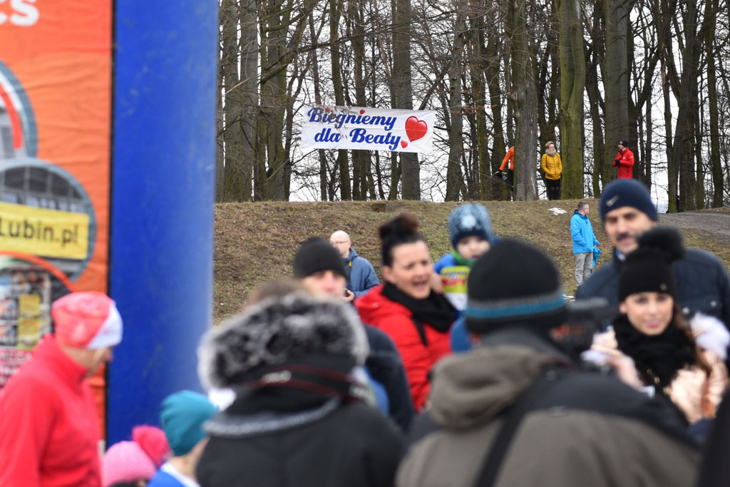 Pobiegli dla Beaty żeby uratować jej chorą nogę