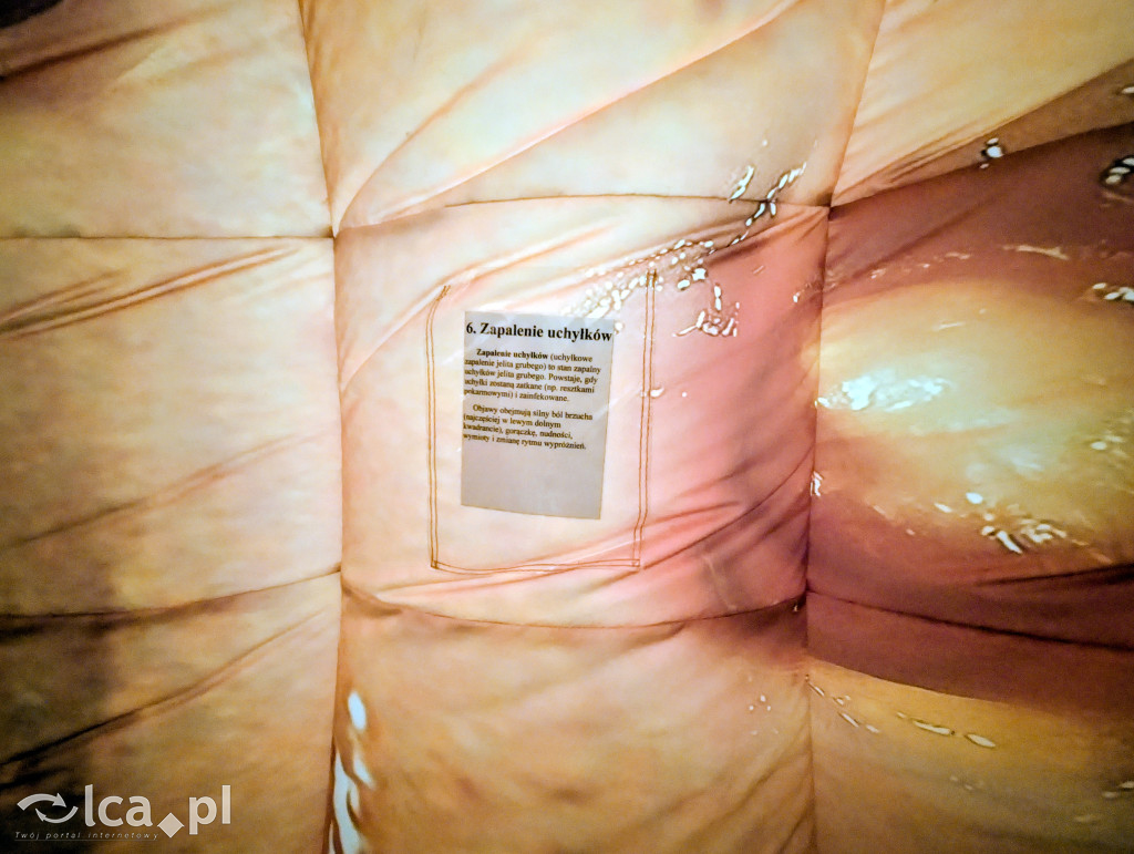 Model 3D jelita i profilaktyka w Centrum Witelona