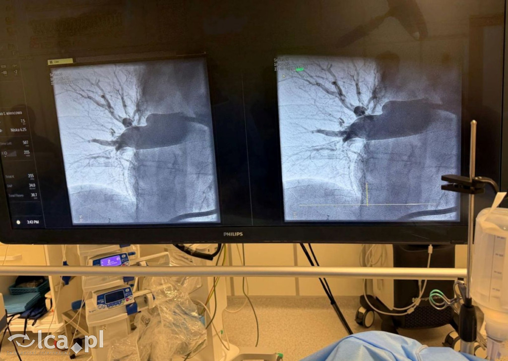 Pierwszy taki zabieg w szpitalu