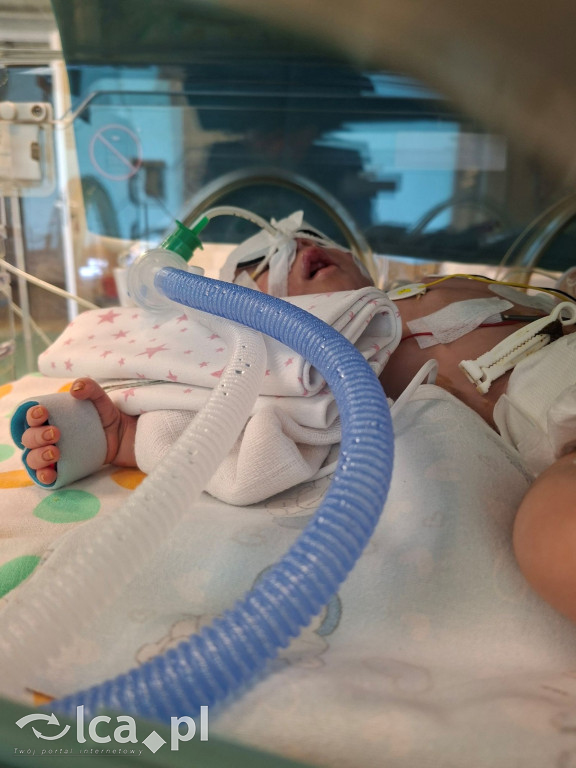 Legniccy lekarze w boju o życie malucha