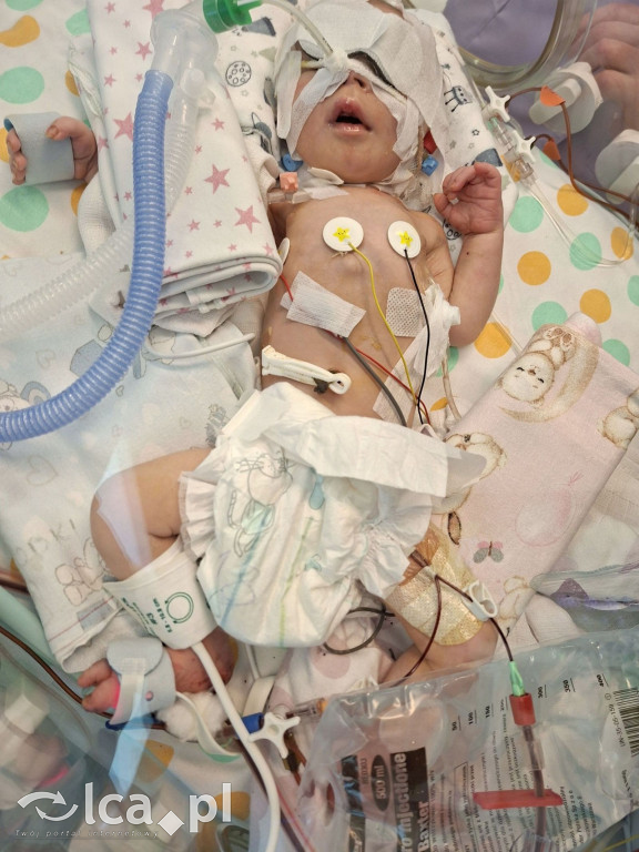 Legniccy lekarze w boju o życie malucha