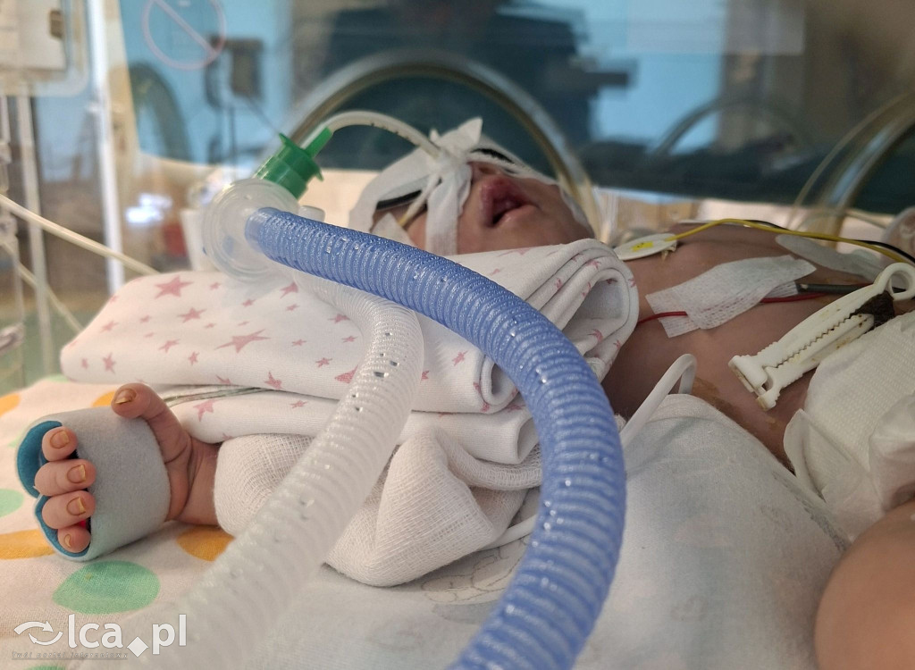 Legniccy lekarze w boju o życie malucha