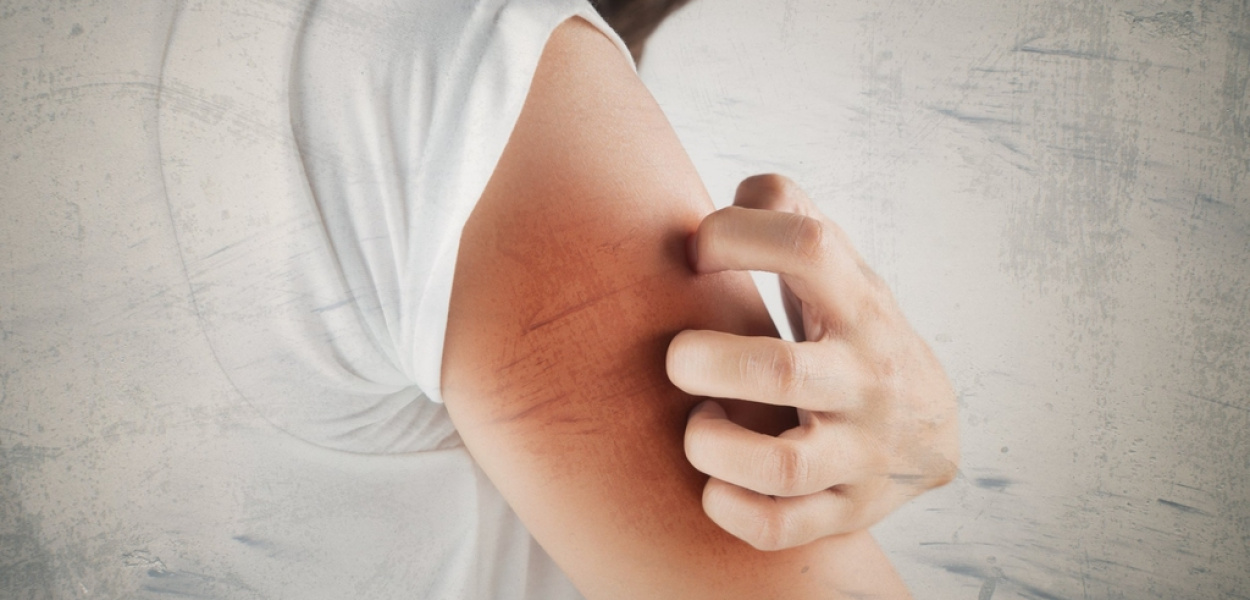 Alergia na nikiel – jak sobie z nią radzić?