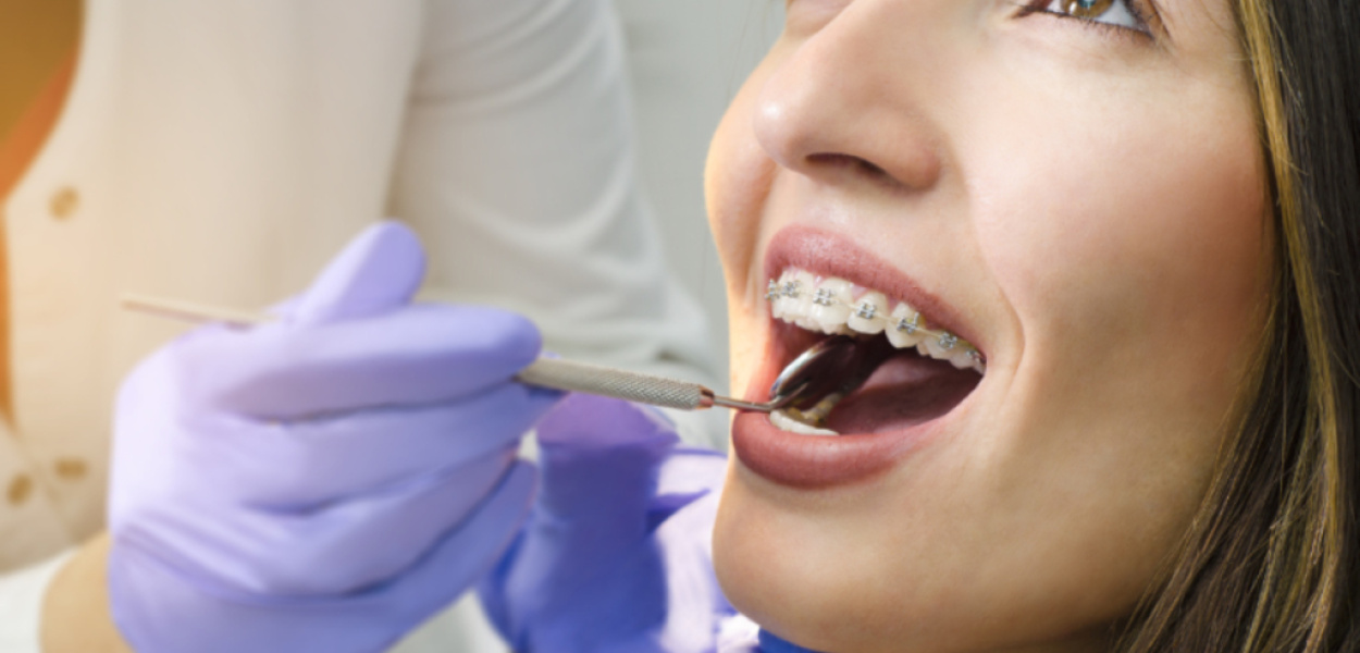 Ortodonci Kraków - jak wygląda wizyta i na czym polega leczenie?
