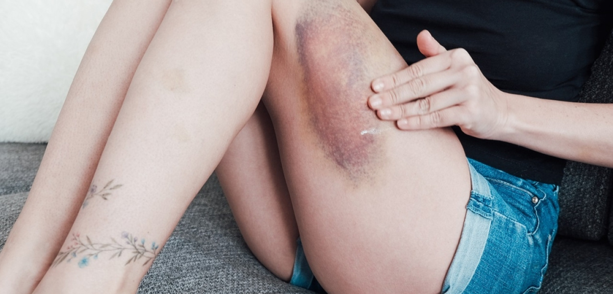 Jak działa maść żywokostowa?