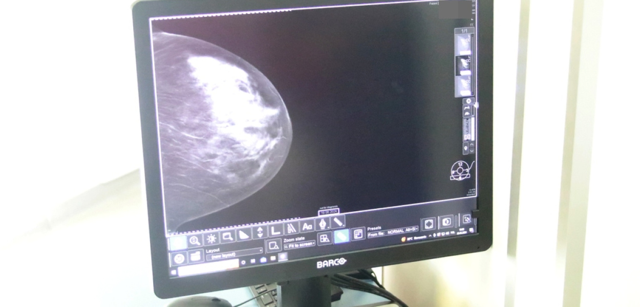 Technologia 3D wkroczyła do ODO. Badania piersi jeszcze dokładniejsze