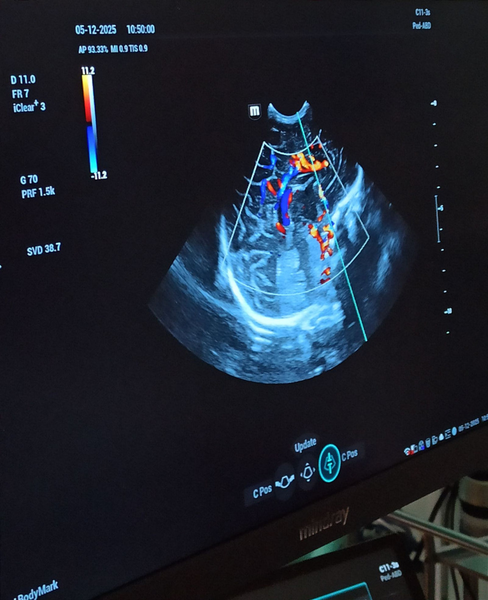 Ten sprzęt ułatwi lekarzom diagnozowanie wcześniaków i noworodków (mat. prasowe)