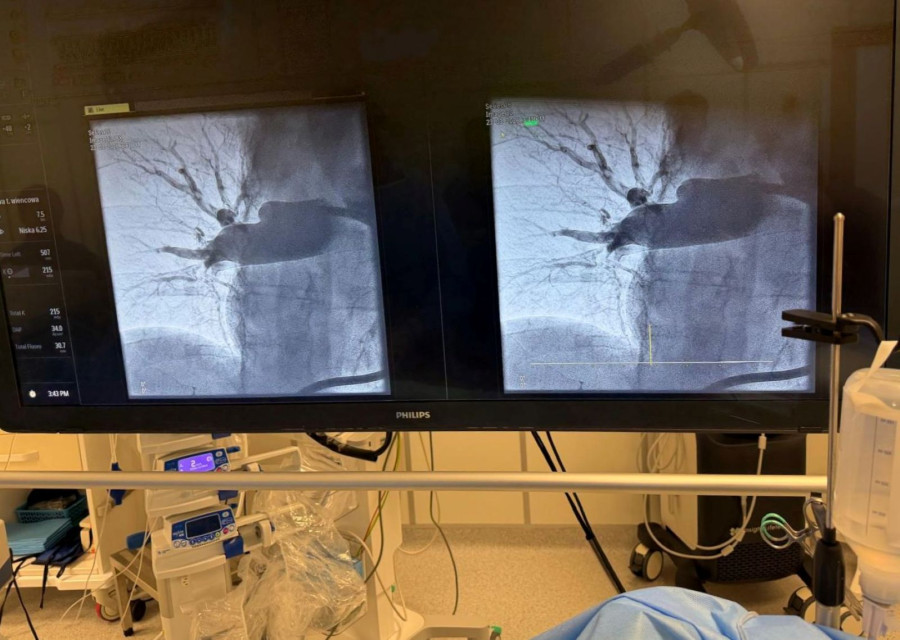 Pierwsza trombektomia płucna w Legnicy (mat. prasowe)