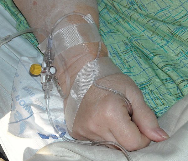 Pacjenci apelują o zmiany. Chodzi o dostęp do nowoczesnych terapii-109318