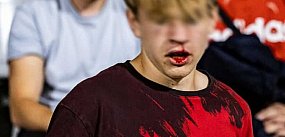 Jest tymczasowy areszt dla stadionowego agresora