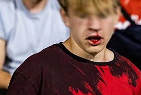 Jest tymczasowy areszt dla stadionowego agresora - 118782