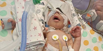 Stoczyli bój o jego życie, jest nadzieja po trudnym początku